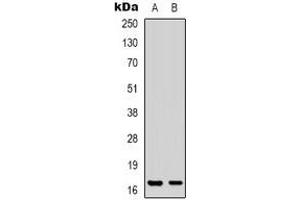 Western blot analysis of CPI17 expression in Jurkat (A), HT29 (B) whole cell lysates.