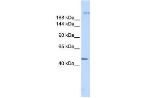 WB Suggested Anti-FER1L3 Antibody Titration:  0. (Myoferlin 抗体  (C-Term))