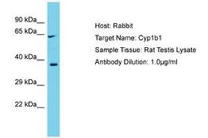 Image no. 1 for anti-Cytochrome P450, Family 1, Subfamily B, Polypeptide 1 (CYP1B1) (AA 294-343) antibody (ABIN6750328) (CYP1B1 抗体  (AA 294-343))