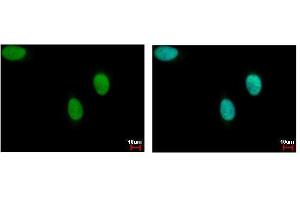 ICC/IF Image DNA ligase III antibody detects LIG3 protein at nucleus by immunofluorescent analysis. (LIG3 抗体)