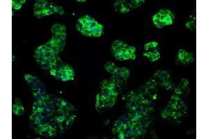 Immunofluorescent staining of HeLa cells using anti-RNF144B mouse monoclonal antibody (ABIN2453607). (RNF144B 抗体  (AA 1-256))