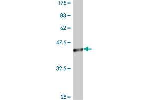 Western Blot detection against Immunogen (38. (Casein Kinase 1 delta 抗体  (AA 301-415))
