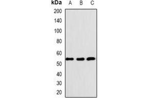 Western blot analysis of BAF57 expression in K562 (A), SHSY5Y (B), SKOV3 (C) whole cell lysates. (SMARCE1 抗体)