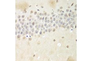 Immunohistochemistry of paraffin-embedded mouse brain using Nono Antibody (ABIN5973035) at dilution of 1/100 (40x lens). (NONO 抗体)