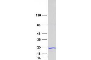 Western Blotting (WB) image for Family with Sequence Similarity 107, Member A (FAM107A) (Transcript Variant 2) protein (Myc-DYKDDDDK Tag) (ABIN2720724)