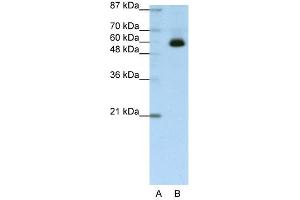 WB Suggested Anti-ZNF307 Antibody Titration:  1. (ZKSCAN4 抗体  (C-Term))