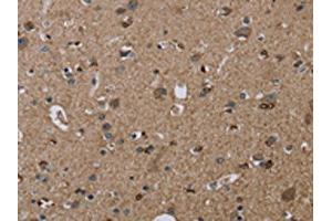 Immunohistochemistry (IHC) image for anti-Transient Receptor Potential Cation Channel, Subfamily M, Member 1 (TRPM1) antibody (ABIN7192919)