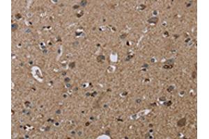 The image on the left is immunohistochemistry of paraffin-embedded Human brain tissue using ABIN7192919(TRPM1 Antibody) at dilution 1/20, on the right is treated with synthetic peptide. (TRPM1 抗体)