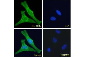 ABIN6391356 Immunofluorescence analysis of paraformaldehyde fixed HeLa cells, permeabilized with 0. (Cadherin 5 抗体  (Internal Region))