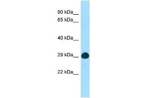 Western Blotting (WB) image for anti-Solute Carrier Family 25 (Mitochondrial Carrier, Ornithine Transporter) Member 2 (SLC25A2) (C-Term) antibody (ABIN2790230)