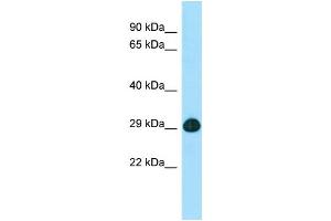 WB Suggested Anti-SLC25A2 Antibody Titration: 1. (SLC25A2 抗体  (C-Term))