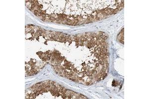 Immunohistochemical staining of human testis with ARD1B polyclonal antibody  shows distinct cytoplasmic positivity in seminiferus duct cells at 1:500-1:1000 dilution. (NAA11 抗体)