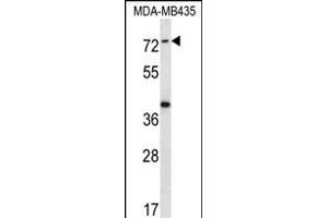 SYTL1 Antibody (Center) (ABIN656741 and ABIN2845964) western blot analysis in MDA-M cell line lysates (35 μg/lane). (SYTL1 抗体  (AA 296-325))