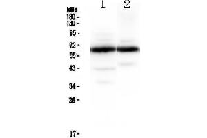 Western blot analysis of Synaptotagmin 1 using anti-Synaptotagmin 1 antibody . (SYT1 抗体)