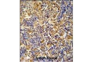 IBTK antibody (Center) (ABIN654688 and ABIN2844380) immunohistochemistry analysis in formalin fixed and paraffin embedded human lymph tissue followed by peroxidase conjugation of the secondary antibody and DAB staining. (IBTK 抗体  (AA 586-613))