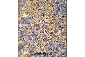 IBTK antibody (Center) (ABIN654688 and ABIN2844380) immunohistochemistry analysis in formalin fixed and paraffin embedded human lymph tissue followed by peroxidase conjugation of the secondary antibody and DAB staining. (IBTK 抗体  (AA 586-613))