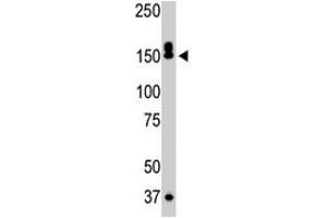 The DAPK1 polyclonal antibody  is used in Western blot to detect DAPK1 in mouse liver tissue lysate. (DAP Kinase 1 抗体  (C-Term))