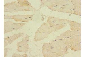 Immunohistochemistry (IHC) image for anti-Calcium Channel, Voltage-Dependent, alpha 2/delta Subunit 4 (CACNA2D4) (AA 934-1115) antibody (ABIN7175582)