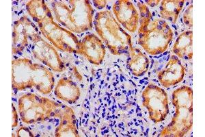 Immunohistochemistry of paraffin-embedded human kidney tissue using ABIN7159794 at dilution of 1:100 (MAST3 抗体  (AA 1101-1309))