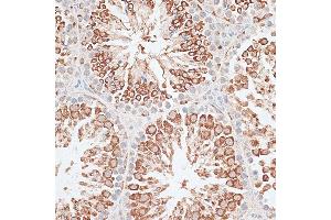 Immunohistochemistry of paraffin-embedded Mouse testis using KIF2C/MCAK antibody (ABIN6128155, ABIN6142869, ABIN6142870 and ABIN6221103) at dilution of 1:100 (40x lens). (KIF2C 抗体  (AA 1-190))