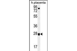 TOR2A Antibody (Center) (ABIN656112 and ABIN2850491) western blot analysis in human placenta tissue lysates (35 μg/lane). (TOR2A 抗体  (AA 194-221))