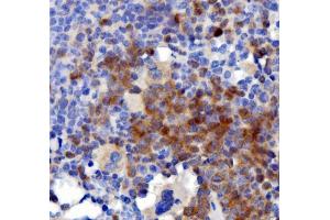 IHC analysis of IL3 using anti-IL3 antibody (ABIN7602653).