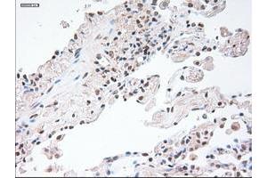 Image no. 1 for anti-Glial Fibrillary Acidic Protein (GFAP) antibody (ABIN1498436) (GFAP 抗体)