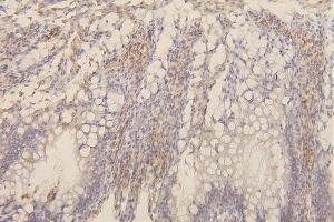 IHC analysis of Collagen III/COL3A1 using anti-Collagen III/COL3A1 antibody (ABIN6719296).
