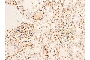 Immunohistochemistry (IHC) image for anti-Neurotrophic Tyrosine Kinase, Receptor, Type 1 (NTRK1) (pTyr681), (Tyr680) antibody (ABIN6256787)
