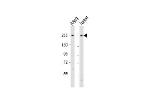All lanes : Anti-COL11A1 Antibody (N-Term) at 1:2000 dilution Lane 1: A549 whole cell lysate Lane 2: Jurkat whole cell lysate Lysates/proteins at 20 μg per lane. (COL11A1 抗体  (AA 41-75))