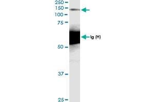 Immunoprecipitation of MCM2 transfected lysate using anti-MCM2 MaxPab rabbit polyclonal antibody and Protein A Magnetic Bead , and immunoblotted with MCM2 MaxPab rabbit polyclonal antibody (D01) . (MCM2 抗体  (AA 1-904))