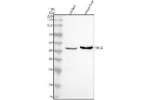 Western blot analysis of NEU2 using anti-NEU2 antibody (ABIN7825818).