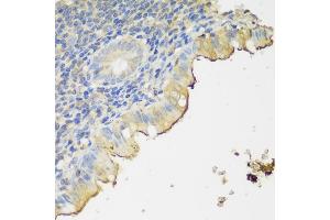 Immunohistochemistry of paraffin-embedded human appendix using CLN5 antibody (ABIN6133293, ABIN6138735, ABIN6138736 and ABIN6216682) at dilution of 1:150 (40x lens). (CLN5 抗体  (AA 96-407))