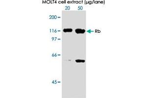 Western blot analysis in extracts from MOLT 4 cell using RB1 (phospho S612) monoclonal antibody, clone 3C11 . (Retinoblastoma 1 抗体  (pSer612))