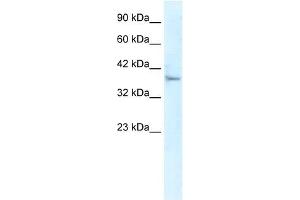 Western Blot showing KLHL14 antibody used at a concentration of 1-2 ug/ml to detect its target protein. (KLHL14 抗体  (N-Term))