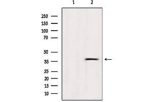 Western blot analysis of extracts from Hela, using OR5R1 Antibody. (OR5R1 抗体  (Internal Region))