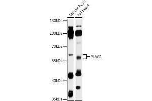 Western blot analysis of extracts of various cell lines, using PL antibody (ABIN7269418) at 1:1000 dilution. (PLAG1 抗体  (AA 33-288))