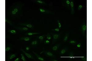 Immunofluorescence of monoclonal antibody to HDAC3 on HeLa cell. (HDAC3 抗体  (AA 1-428))