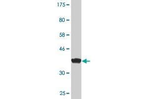 Western Blot detection against Immunogen (38. (ZAK 抗体  (AA 1-120))