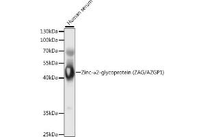 Western blot analysis of extracts of human serum, using Zinc-α2-glycoprotein (ZAG/Zinc-α2-glycoprotein (ZAG/)) antibody (ABIN6131435, ABIN6137386, ABIN6137387 and ABIN6221006) at 1:1000 dilution. (AZGP1 抗体  (AA 21-298))