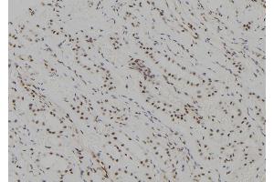 ABIN6277620 at 1/100 staining Human kidney tissue by IHC-P. (UBE2C 抗体  (C-Term))