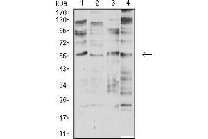 Western blot analysis using CHRNA2 mouse mAb against SK-N-SH (1), SH-SY5Y (2), membrane protein of C6 (3), and SW480 (4) cell lysate. (CHRNA2 抗体  (AA 27-264))