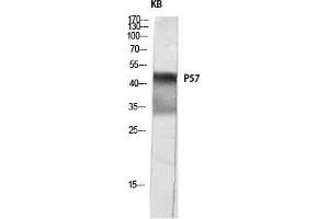 Western Blot (WB) analysis of KB lysis using p57 antibody. (P57 (Ser238) 抗体)
