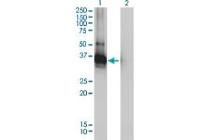 Western Blotting (WB) image for anti-Low Density Lipoprotein Receptor Adaptor Protein 1 (LDLRAP1) (AA 1-263) antibody (ABIN565226)