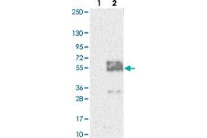 Western blot analysis of Lane 1: Negative control (vector only transfected HEK293T lysate). (MFSD8 抗体)
