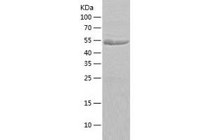 Western Blotting (WB) image for Glucose-6-Phosphate Dehydrogenase (G6PD) (AA 1-491) protein (His tag) (ABIN7285305) (Glucose-6-Phosphate Dehydrogenase Protein (G6PD) (AA 1-491) (His tag))