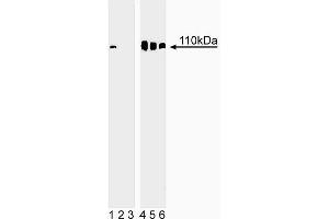 Western blot analysis of Rb (pS780) in human embryonic skin cells. (Retinoblastoma 1 抗体  (pSer780))