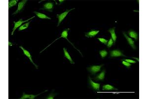 Immunofluorescence of purified MaxPab antibody to ELAVL4 on HeLa cell. (ELAVL4 抗体  (AA 1-366))