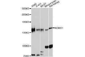 Western blot analysis of extracts of various cell lines, using NOMO1 antibody (ABIN5998361) at 1:7000 dilution. (NOMO1 抗体)