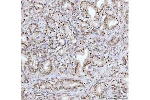 IHC analysis of DHX15/prp43 using anti-DHX15/prp43 antibody (ABIN7602738).